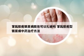 掌跖膿皰銀屑病膿包可以扎破嗎 掌跖膿皰型銀屑病中藥治療方法