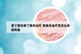 用了激光用了激光治療 用激光治療完怎么快速恢復(fù)