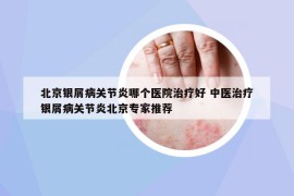 北京銀屑病關(guān)節(jié)炎哪個(gè)醫(yī)院治療好 中醫(yī)治療銀屑病關(guān)節(jié)炎北京專家推薦