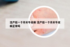 流產(chǎn)后一個(gè)月長(zhǎng)牛皮癬 流產(chǎn)后一個(gè)月長(zhǎng)牛皮癬正常嗎
