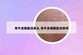 有牛皮癬能紋身么 有牛皮病癬能紋身嗎