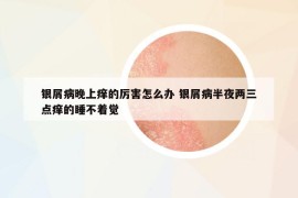 銀屑病晚上癢的厲害怎么辦 銀屑病半夜兩三點癢的睡不著覺