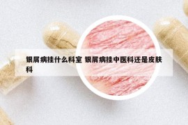 銀屑病掛什么科室 銀屑病掛中醫(yī)科還是皮膚科