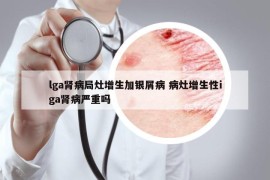 lga腎病局灶增生加銀屑病 病灶增生性iga腎病嚴重嗎