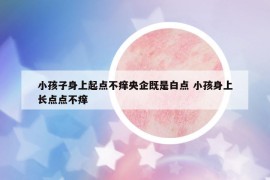 小孩子身上起點(diǎn)不癢央企既是白點(diǎn) 小孩身上長點(diǎn)點(diǎn)不癢