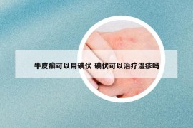 牛皮癬可以用碘伏 碘伏可以治療濕疹嗎