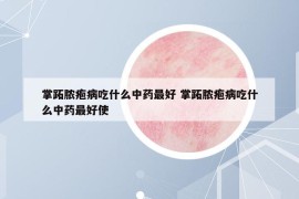 掌跖膿皰病吃什么中藥最好 掌跖膿皰病吃什么中藥最好使