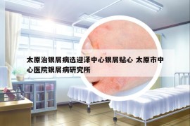 太原治銀屑病選迎澤中心銀屑貼心 太原市中心醫(yī)院銀屑病研究所