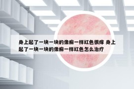 身上起了一塊一塊的像癬一樣紅色很癢 身上起了一塊一塊的像癬一樣紅色怎么治療