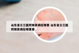 山東省立三醫(yī)院銀屑病在哪里 山東省立三醫(yī)院銀屑病在哪里看