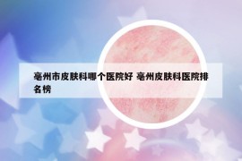 亳州市皮膚科哪個醫(yī)院好 亳州皮膚科醫(yī)院排名榜