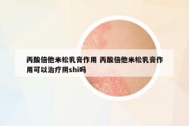 丙酸倍他米松乳膏作用 丙酸倍他米松乳膏作用可以治療陰shi嗎