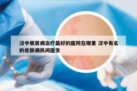 漢中銀屑病治療最好的醫(yī)院在哪里 漢中有名的皮膚病民間醫(yī)生