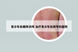 青少年白癜風(fēng)診所 治療青少年白斑專科醫(yī)院