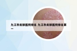 九江市皮膚醫(yī)院排名 九江市皮膚醫(yī)院排名第一