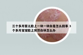 三個(gè)多月嬰兒臉上一塊一塊白是怎么回事 3個(gè)多月寶寶臉上突然白塊怎么辦