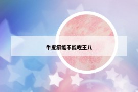 牛皮癬能不能吃王八