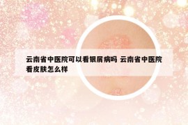 云南省中醫(yī)院可以看銀屑病嗎 云南省中醫(yī)院看皮膚怎么樣