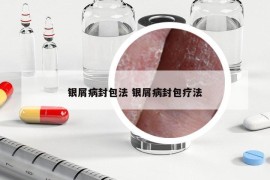 銀屑病封包法 銀屑病封包療法