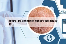 衡水專(zhuān)門(mén)看皮膚的醫(yī)院 衡水哪個(gè)醫(yī)院看皮膚好