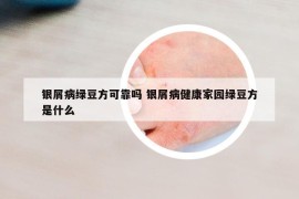 銀屑病綠豆方可靠嗎 銀屑病健康家園綠豆方是什么