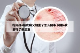 吃阿維a后皮癬又加重了怎么回事 阿維a膠囊吃了癬加重