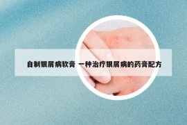 自制銀屑病軟膏 一種治療銀屑病的藥膏配方