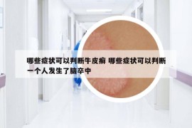 哪些癥狀可以判斷牛皮癬 哪些癥狀可以判斷一個(gè)人發(fā)生了腦卒中