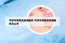 菏澤市博愛皮膚病醫(yī)院 菏澤市博愛皮膚病醫(yī)院怎么樣