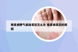 銀屑病脾氣暴躁易怒怎么辦 銀屑病易怒的原因