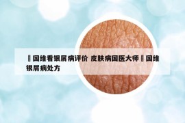 禤國維看銀屑病評價 皮膚病國醫(yī)大師禤國維銀屑病處方