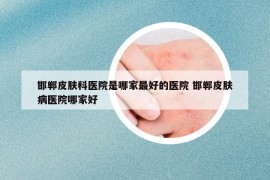 邯鄲皮膚科醫(yī)院是哪家最好的醫(yī)院 邯鄲皮膚病醫(yī)院哪家好