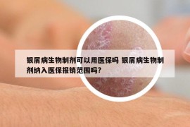 銀屑病生物制劑可以用醫(yī)保嗎 銀屑病生物制劑納入醫(yī)保報(bào)銷范圍嗎?