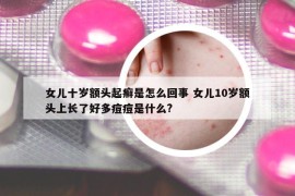 女兒十歲額頭起癬是怎么回事 女兒10歲額頭上長了好多痘痘是什么?