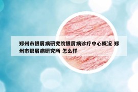 鄭州市銀屑病研究院銀屑病診療中心概況 鄭州市銀屑病研究所 怎么樣