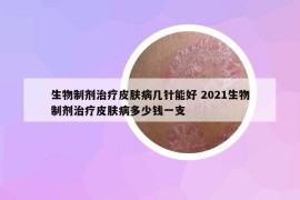 生物制劑治療皮膚病幾針能好 2021生物制劑治療皮膚病多少錢一支