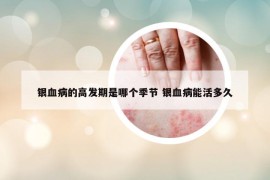 銀血病的高發(fā)期是哪個季節(jié) 銀血病能活多久