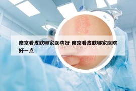 南京看皮膚哪家醫(yī)院好 南京看皮膚哪家醫(yī)院好一點
