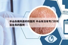 中山白癜風(fēng)最好的醫(yī)院 中山有沒有專門針對(duì)治白發(fā)的醫(yī)院