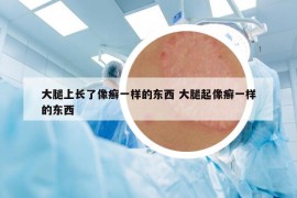 大腿上長(zhǎng)了像癬一樣的東西 大腿起像癬一樣的東西