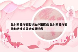 注射用硫代硫酸鈉治療銀屑病 注射用硫代硫酸鈉治療銀屑病效果好嗎