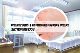 脾氨肽口服凍干粉對銀屑病有幫助嗎 脾氨肽治療銀屑病的文章