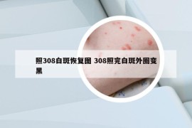 照308白斑恢復(fù)圖 308照完白斑外圈變黑