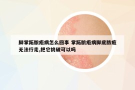 腳掌跖膿皰病怎么回事 掌跖膿皰病腳底膿皰無法行走,把它挑破可以嗎