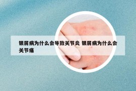 銀屑病為什么會導致關節(jié)炎 銀屑病為什么會關節(jié)痛