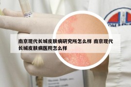 南京現(xiàn)代長城皮膚病研究所怎么樣 南京現(xiàn)代長城皮膚病醫(yī)院怎么樣