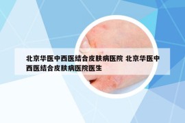 北京華醫(yī)中西醫(yī)結(jié)合皮膚病醫(yī)院 北京華醫(yī)中西醫(yī)結(jié)合皮膚病醫(yī)院醫(yī)生