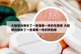 大腿根內(nèi)側(cè)長了一些像癬一樣的東西癢 大腿根內(nèi)側(cè)長了一些像癬一樣的特別癢