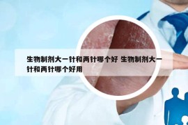 生物制劑大一針和兩針哪個好 生物制劑大一針和兩針哪個好用