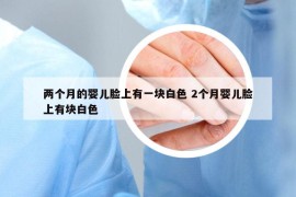 兩個月的嬰兒臉上有一塊白色 2個月嬰兒臉上有塊白色